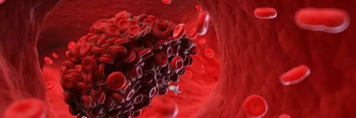 Виділення згустків крові поза менструації