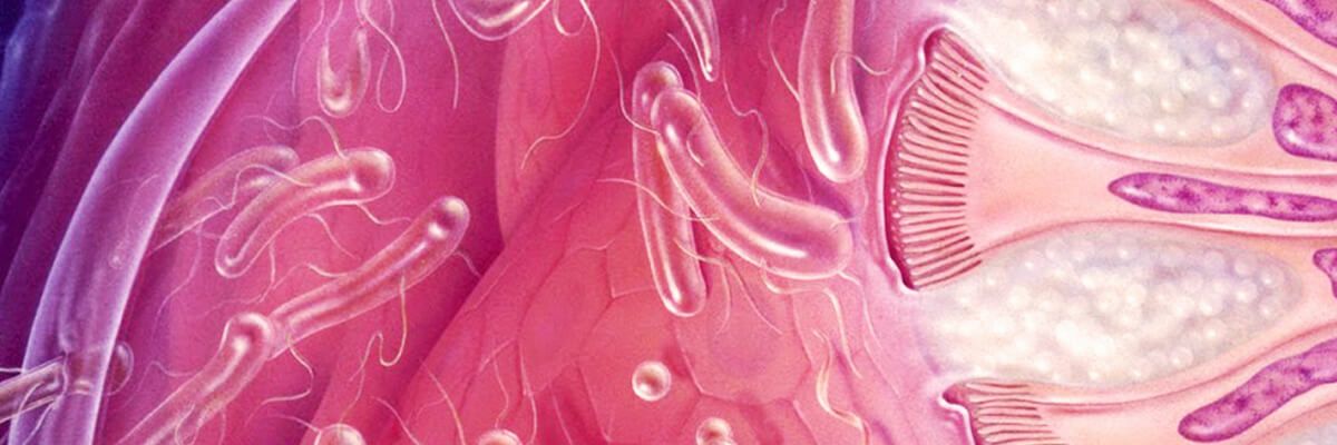 Як запобігти повторній появі бактеріального вагінозу